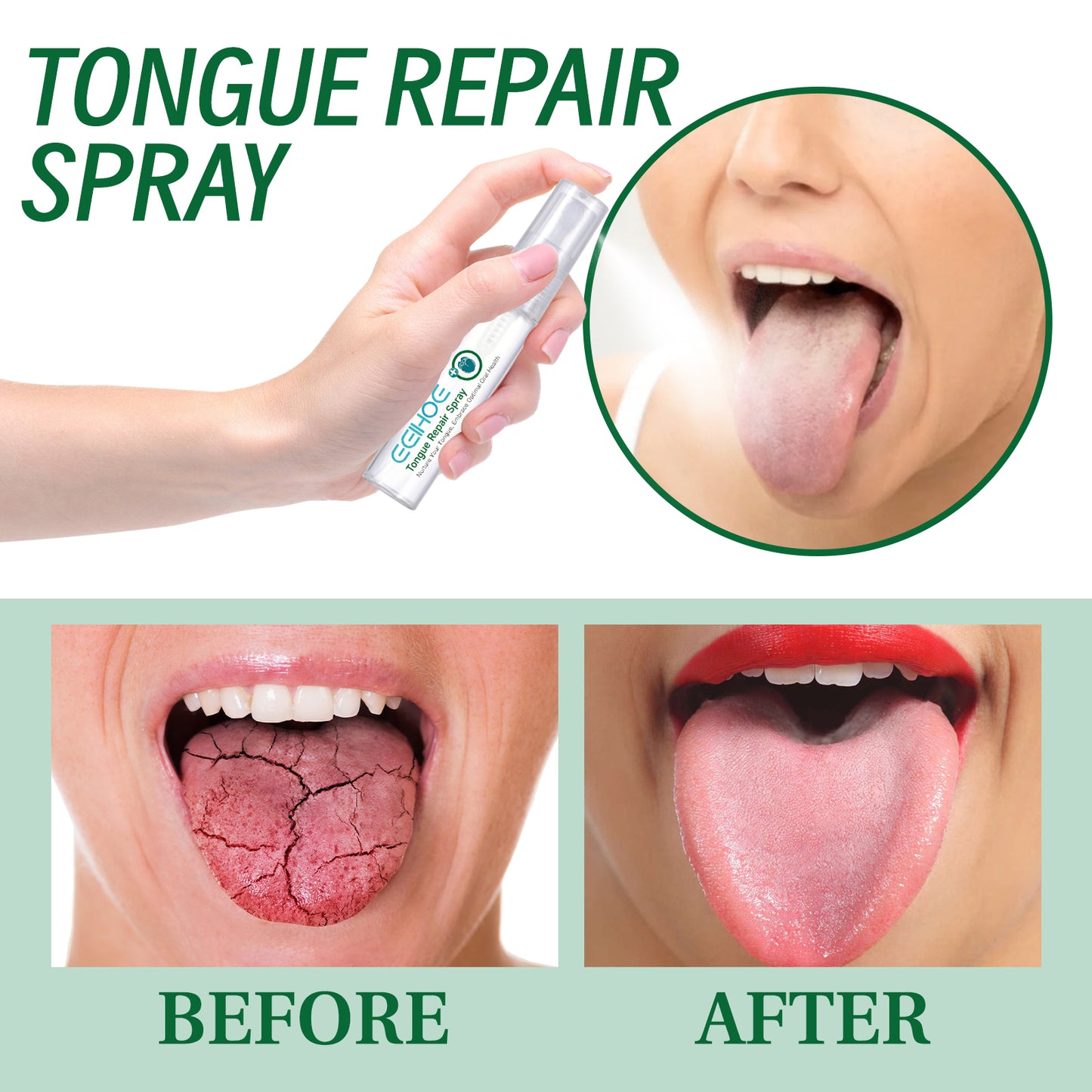 EELHOE Tongue Repair Spray Tongue Coating Repair Spray for Relieving Dry, Cracked, and Swollen Tongue Oral Care