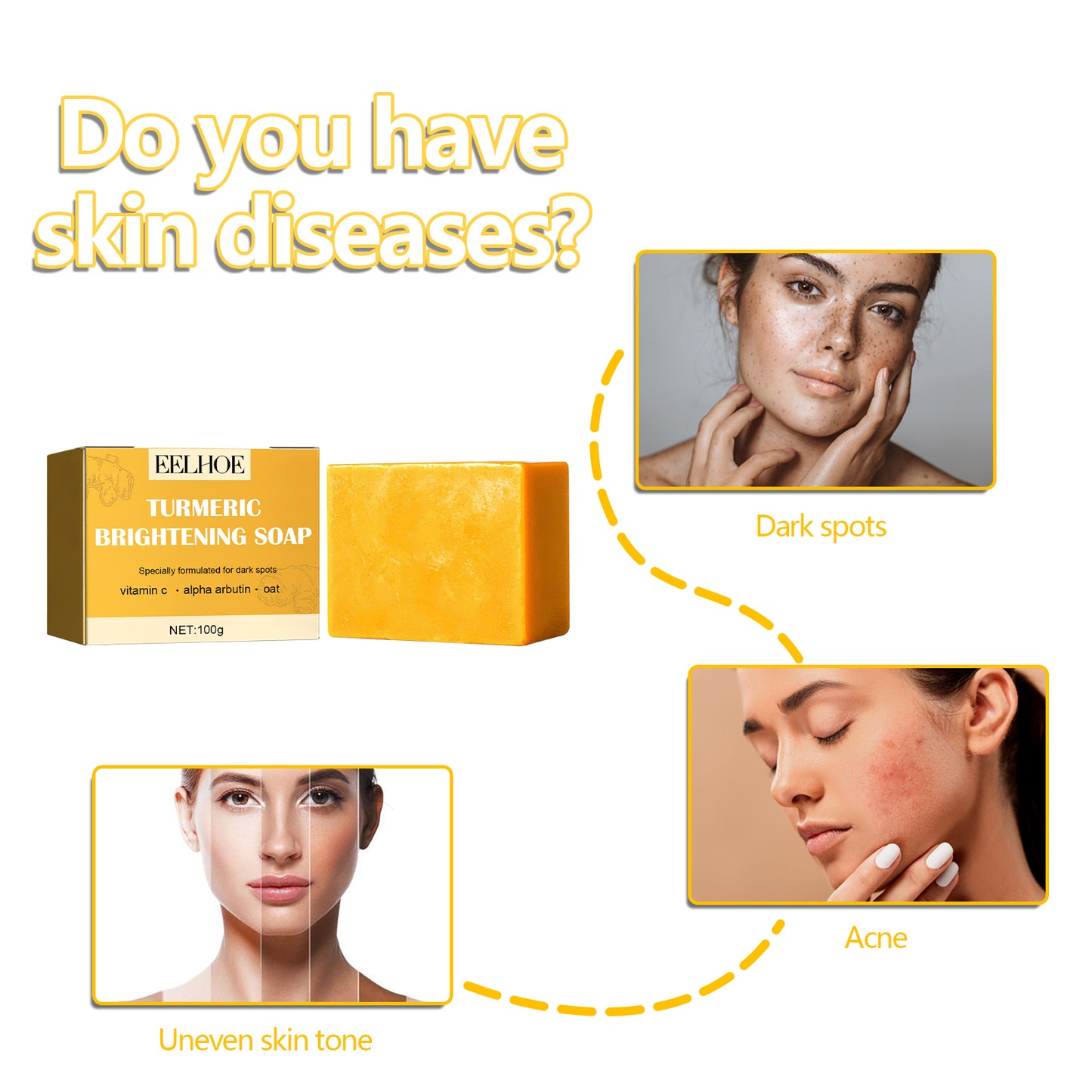 EELHOE Turmeric Cleansing Soap Facial Cleansing Soap for Spot and Acne Fading, Brightening and Softening Skin