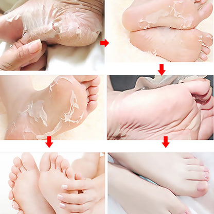 Jaysuing Fruit Acid Exfoliating Foot Mask Moisturizing and Rejuvenating Callus Removal Exfoliating Dead Skin Hydrating Moisturizing Foot Care