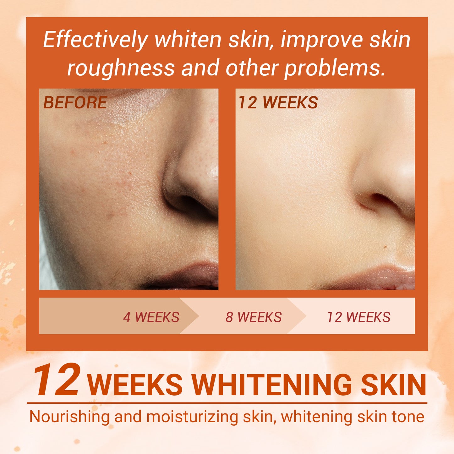 EELHOE Vitamin C Moisturizing Spray Moisture Replenishment Skin Desalting Pimple Color Spot Rejuvenation Whitening Spray