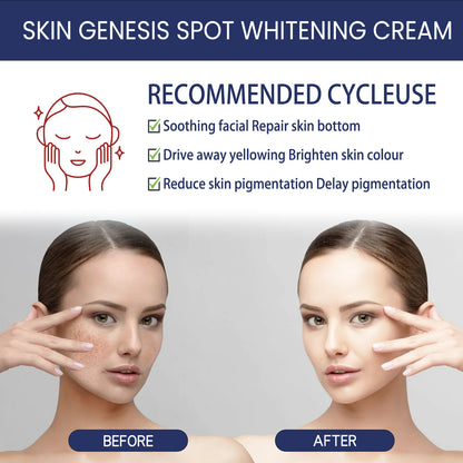 Hoygi Whitening and Spot-Fading Cream Fade Spots Soften Skin Brighten Skin Tone Rejuvenate Delicate Beautiful Skin Moisturizing Cream