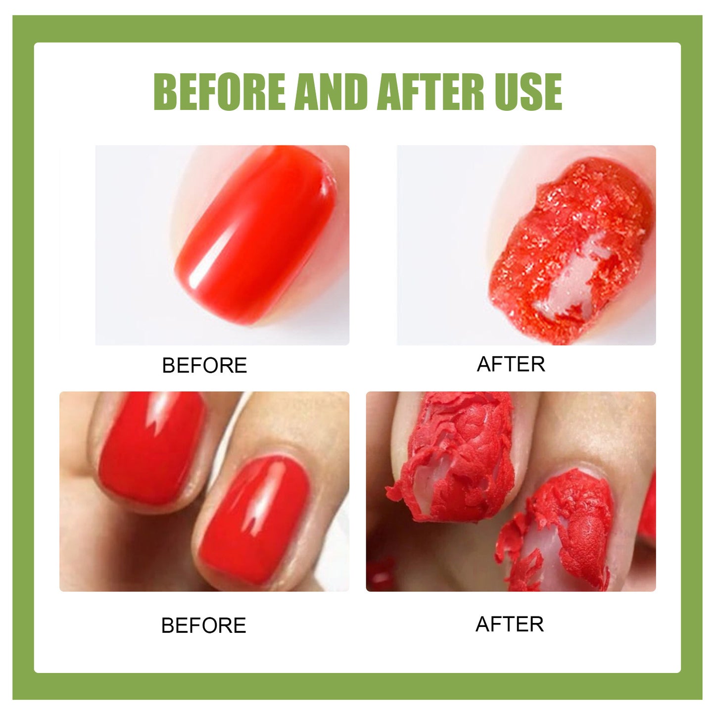 EELHOE Burst Nail Polish Remover Lazy No-Hurt Hand Quick Adhesive Remover for UV Gel Nail Polish, Nail Salon Special Use