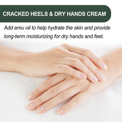 WoodSleep Anti-Chapping Hands and Feet Neck Cream Skin-Friendly Moisturizing and Anti-Cracking Peeling, Freezing, Cracking, Cracking, Hand and Foot Neck Cream