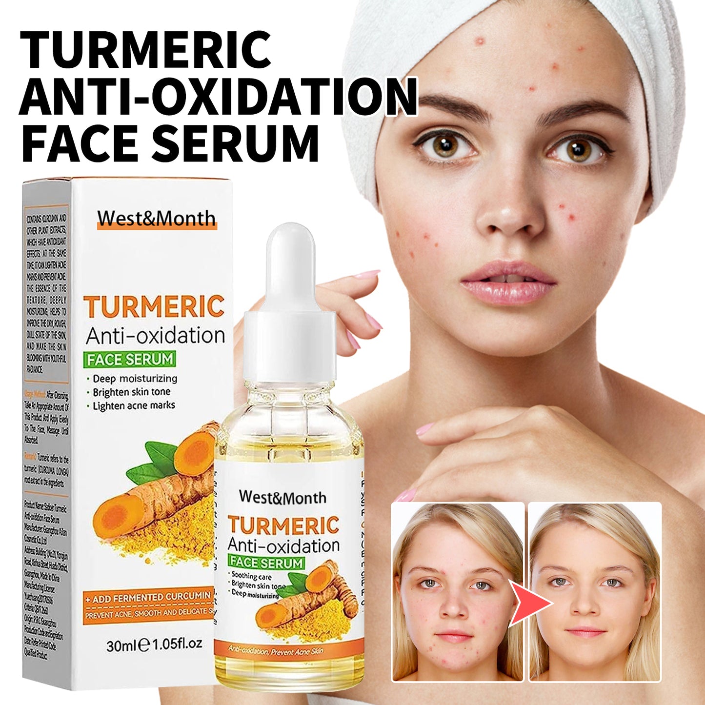 West&Month Turmeric Facial Serum Hydrating Blemish and Acne Scar Brightening Skin Essence