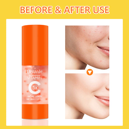 Vit C Face Serum Facial Whitening Brightening Hyaluronic Acid Collagen Vitamin C Dark Spot Corrector Anti-Aging Serums for Face