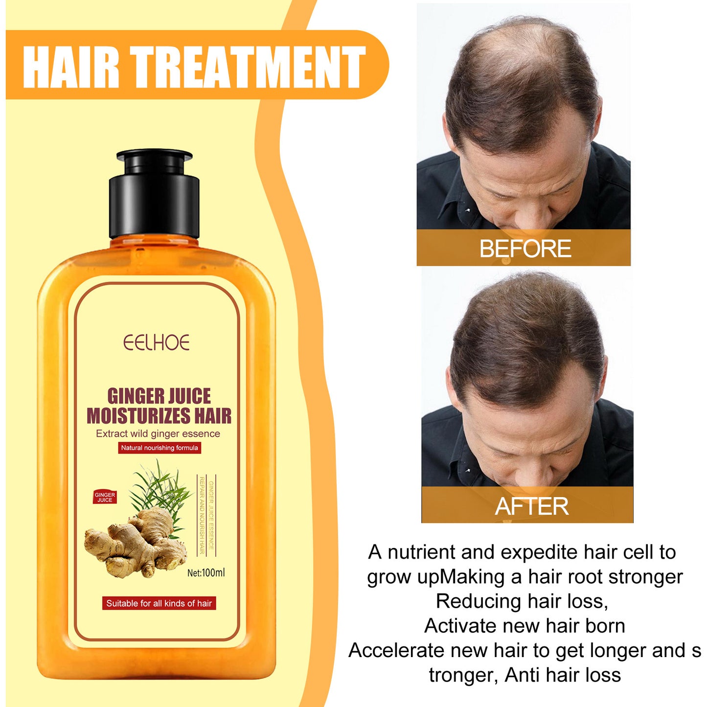 EELHOE Ginger Anti-Hair Loss Shampoo Moisturizing Repair Hair Follicle Strengthening Anti-Hair Loss Firming Shampoo