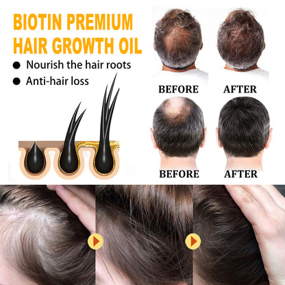 EELHOE Biotin Hair Oil Deep Moisturizing and Improving Scalp Massage Care Smooth Hair Care Essential Oil