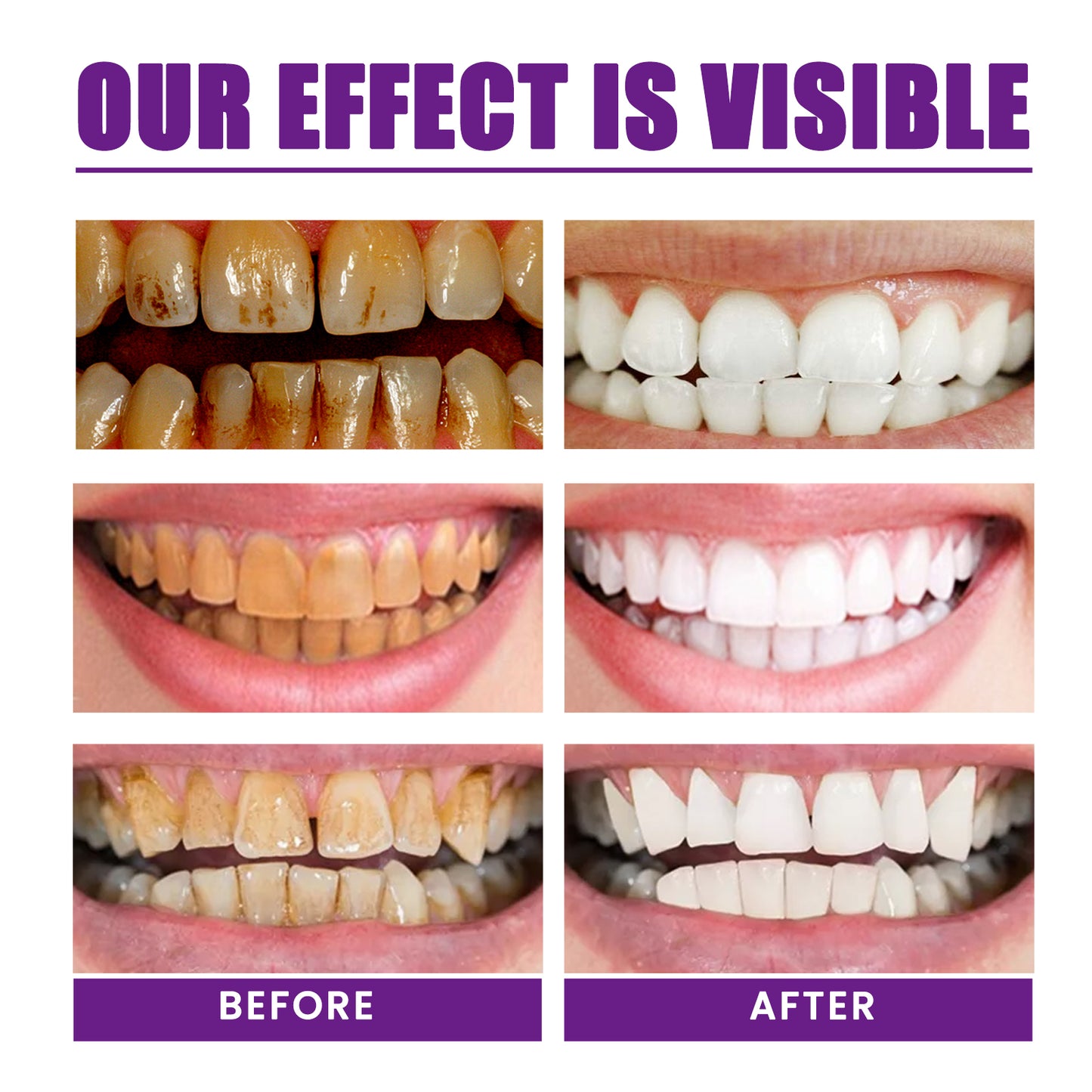 West&Month Purple Whitening Toothpaste Cleans Teeth Stains, Freshens Breath, Protects Gums, Whitens Teeth Toothpaste