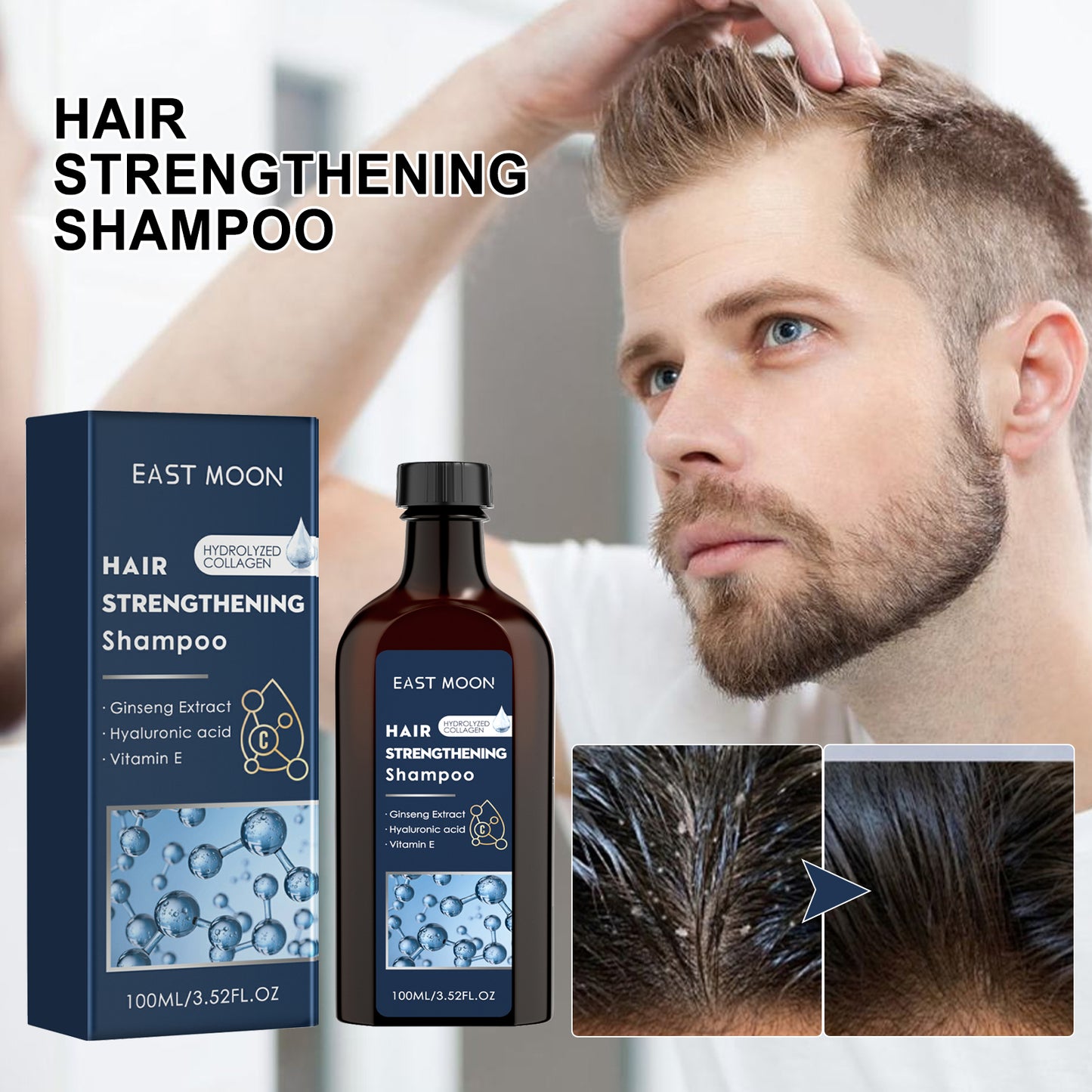 East Moon Men's Shampoo Deep Cleansing Moisturizing Hair Root Scalp Massage Nourishing Care Shampoo