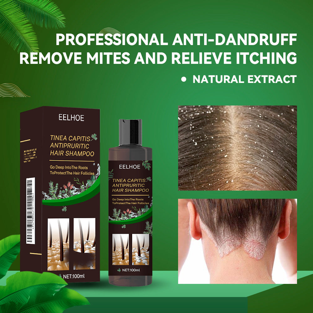 EELHOE Anti-Fungal Itchy Scalp Shampoo Anti-Dandruff Refreshing Oil Control Hair Care Anti-Itch Shampoo