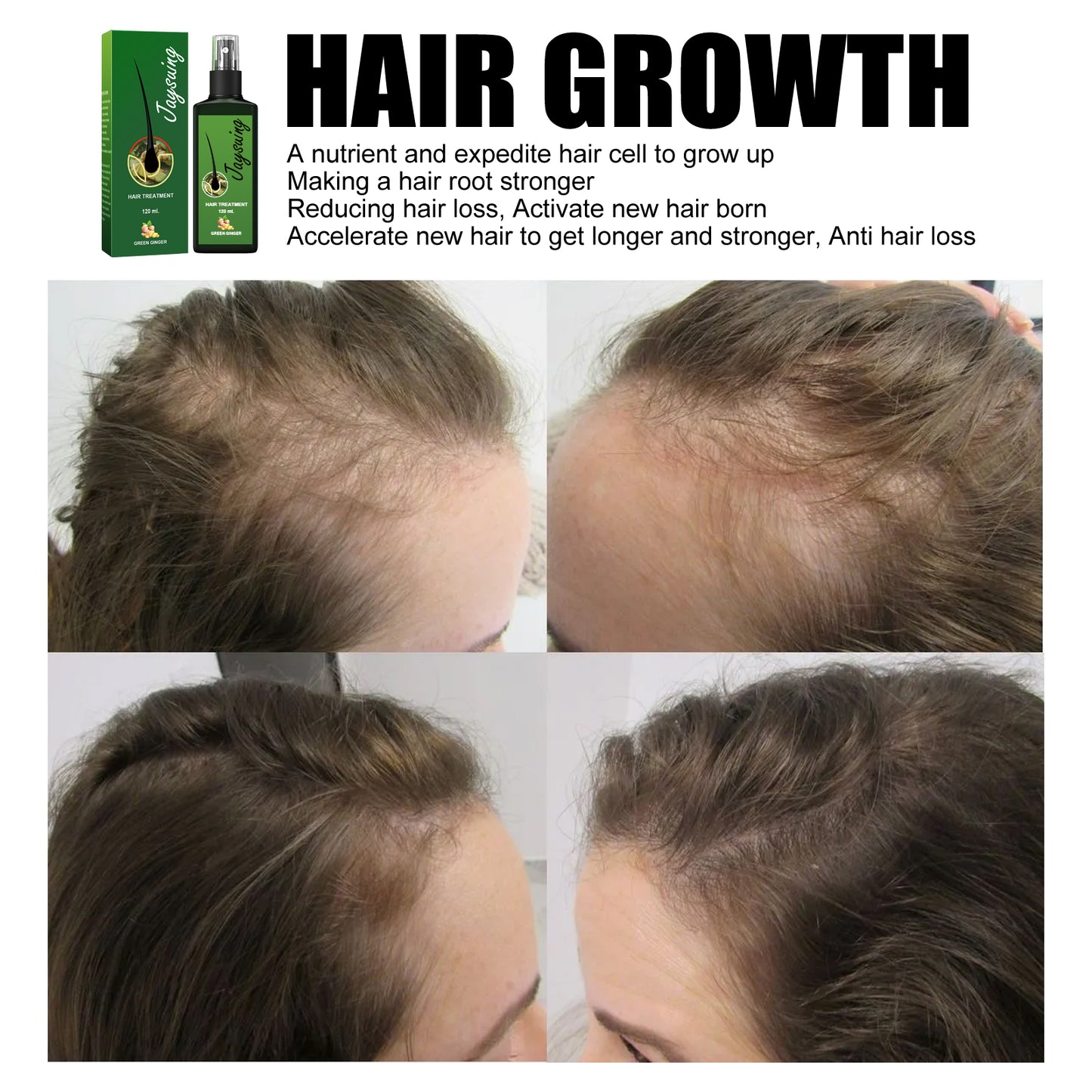 Jaysuing Hair Care Solution Gentle Nourishing Scalp Massage Moisturizing Smooth Hair Care Spray