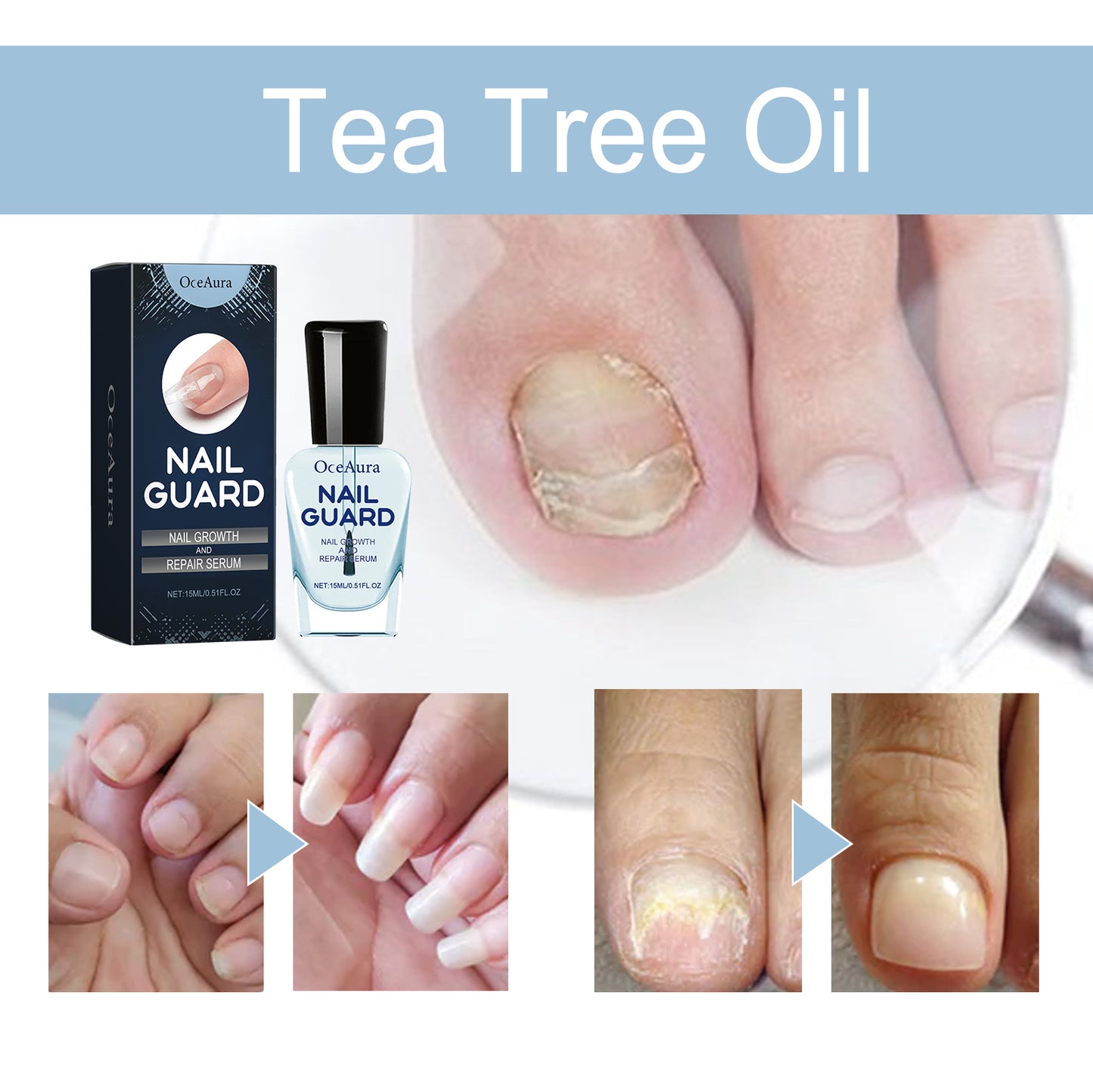 OCEAURA Nail Repair Essence Hand and Foot Nail Nutrition Moisturizing Repair Soft Nail Gentle Cleaning Bright Nail Care