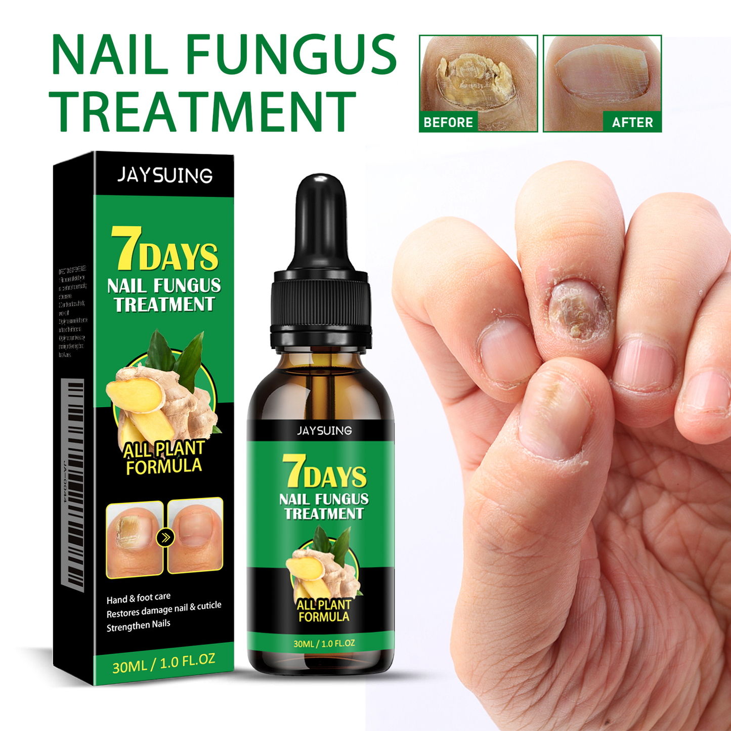 Jaysuing Ginger Nail Care Solution Nail Care Solution for Hands and Feet, Soft Nail Polish, Moisturizing Liquid for Nail Fungus