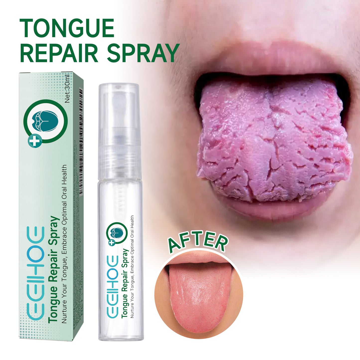 EELHOE Tongue Repair Spray Tongue Coating Repair Spray for Relieving Dry, Cracked, and Swollen Tongue Oral Care