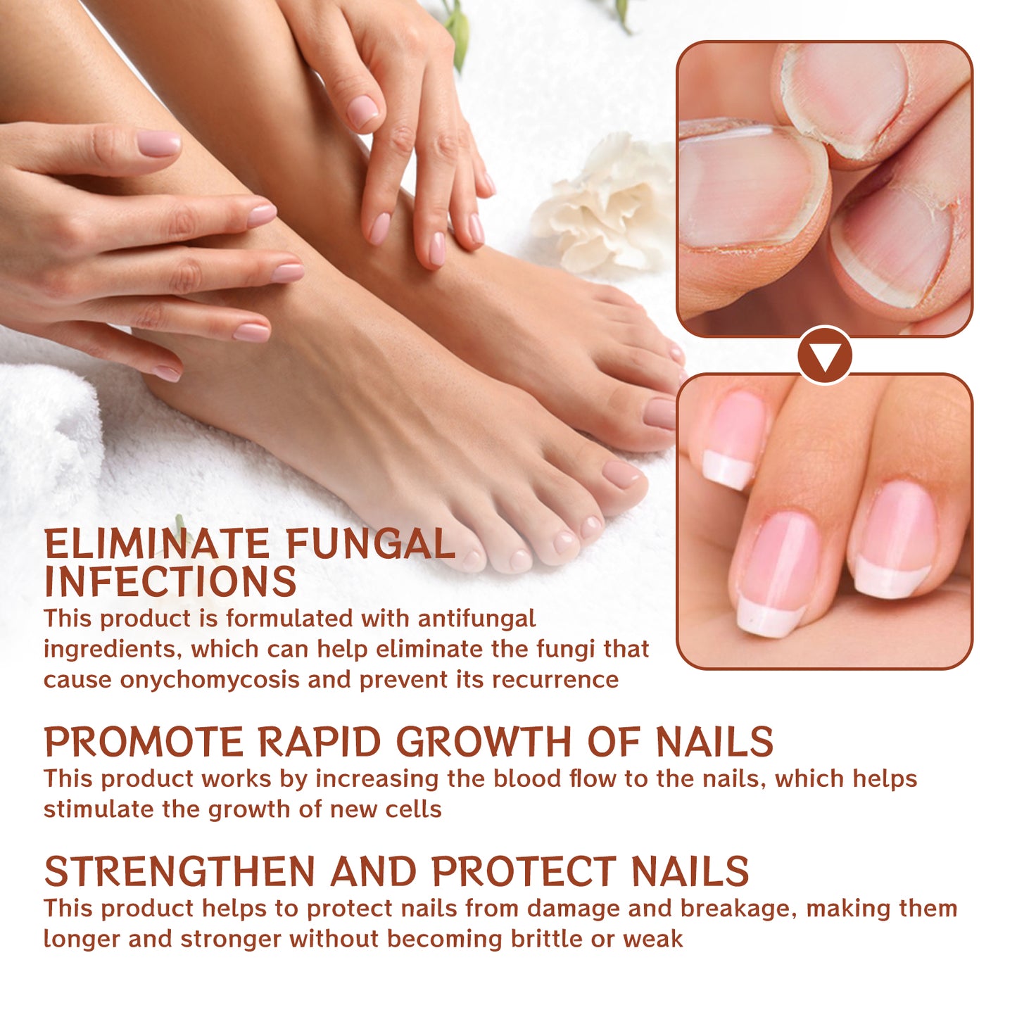 Jaysuing 7Sky Nail Care Essence Gray Nail Hand and Foot Nail Nutritional Cleansing Care Essence