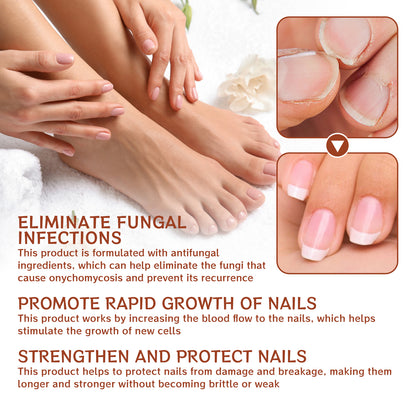 Jaysuing 7Sky Nail Care Essence Gray Nail Hand and Foot Nail Nutritional Cleansing Care Essence