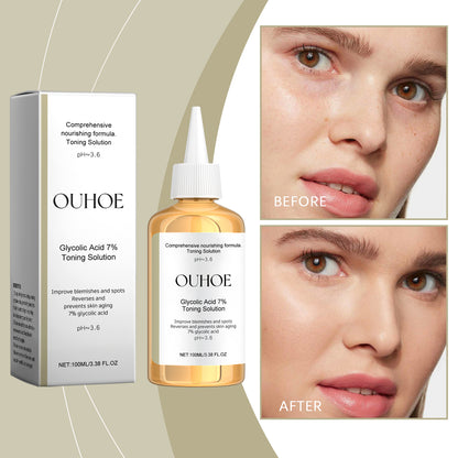 OUHOE Glycolic acid7%Moisturizing Toner，Remove Closed Comedones Improve Skin Condition Rejuvenating Toner Essence