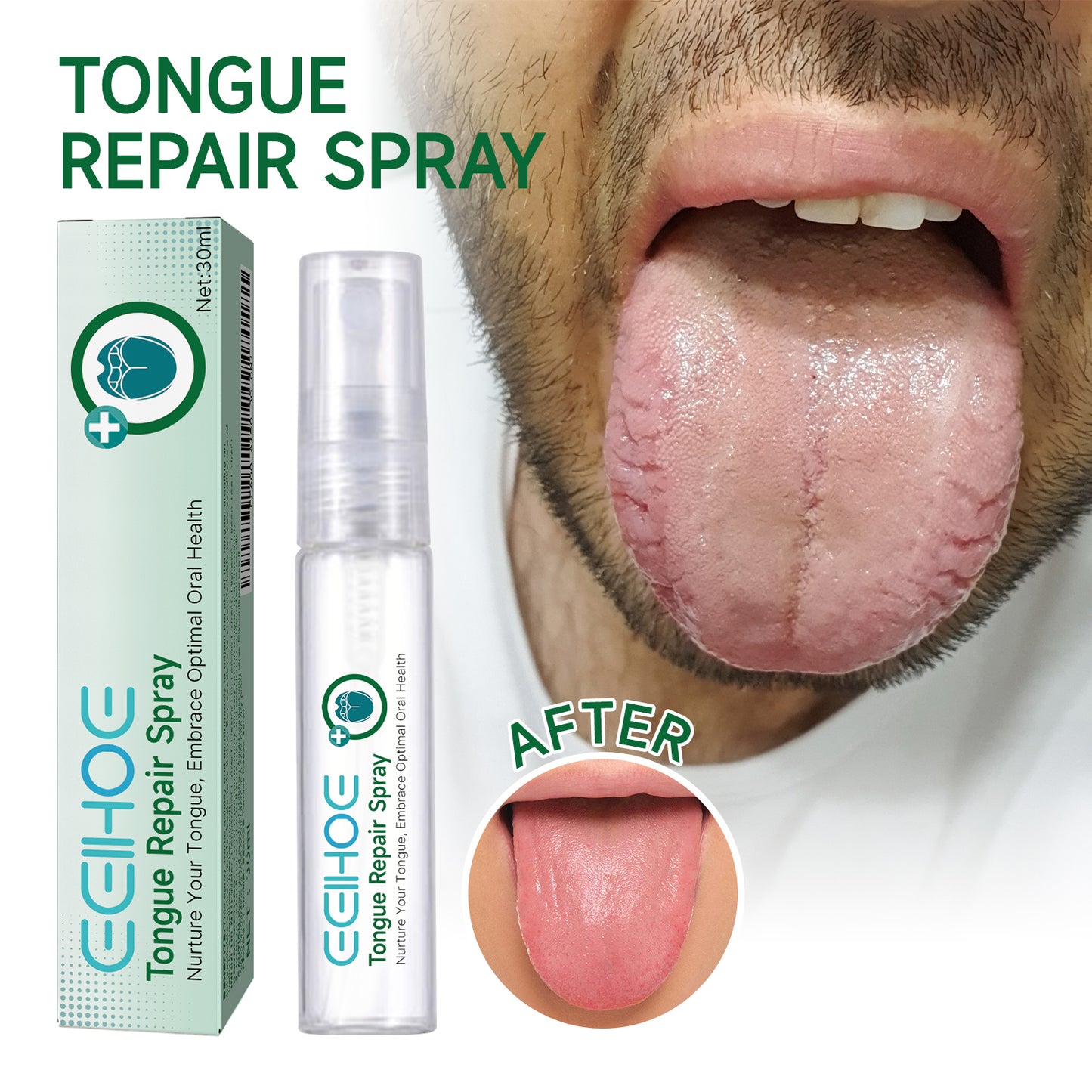 EELHOE Tongue Repair Spray Tongue Coating Repair Spray for Relieving Dry, Cracked, and Swollen Tongue Oral Care