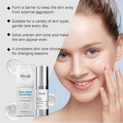 Hoygi Dark Spot Repair Lotion Face Skin Moisturizing Hydrating Apply Skin Care Skin Spots Repair Lotion