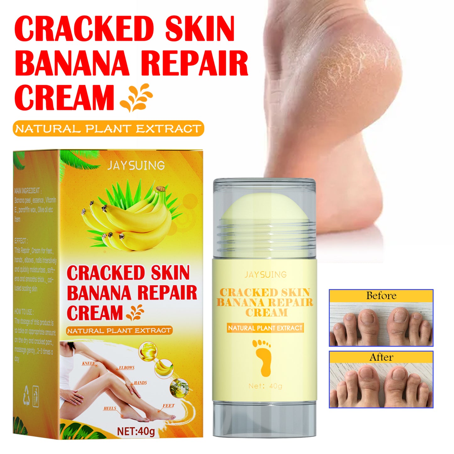 Jaysuing Foot Repair Cream Moisturizing Skin Anti Skin Cracked Dry Itchy Foot Care Repair Cream