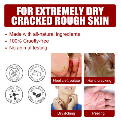 Jaysuing Fruit Acid Exfoliating Foot Mask Moisturizing and Rejuvenating Callus Removal Exfoliating Dead Skin Hydrating Moisturizing Foot Care