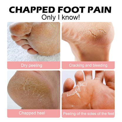 Hoygi Anti-Chap Hand and Foot Moisturizing Stick Foot Care Anti-Dryness Exfoliating Dead Skin Hand and Foot Moisturizing Stick