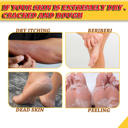 Jaysuing Foot Repair Cream Moisturizing Skin Anti Skin Cracked Dry Itchy Foot Care Repair Cream