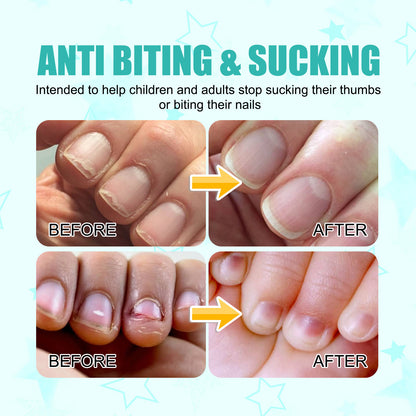 EELHOE Anti-Nail Biting Solution Prevent Infants and Toddlers from Nail Biting Nail Care Solution for Nail Biting Prevention