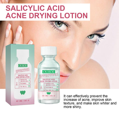 OUHOE Salicylic Acid Acne Lotion Gentle Repair Acne Skin Pore Refinement Facial Moisturizing Lotion