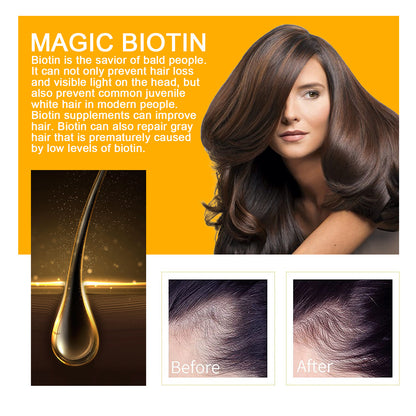 EELHOE Biotin Hair Oil Deep Moisturizing and Improving Scalp Massage Care Smooth Hair Care Essential Oil