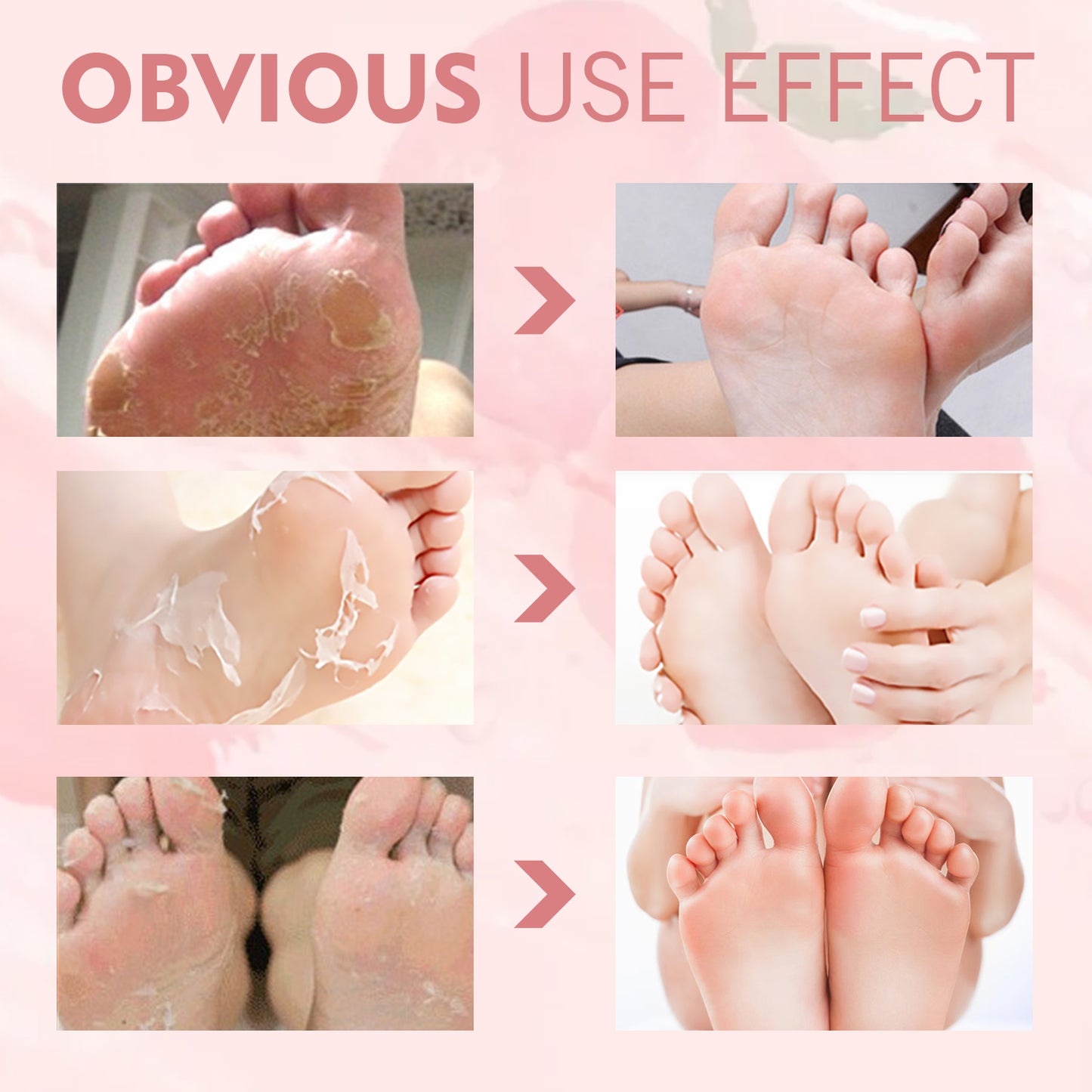 EELHOE Peach Foot Mask Foot Moisturizing Hydrating Smooth Skin Anti-Dryness Callus Removal Care Foot Mask