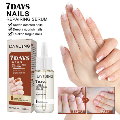 Jaysuing 7Sky Nail Care Essence Gray Nail Hand and Foot Nail Nutritional Cleansing Care Essence