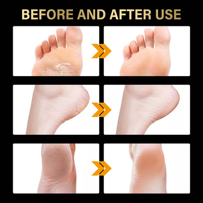 Jaysuing Lavender Exfoliating Foot Mask Exfoliating Foot Care Hydrating Moisturizing Anti-Chapping Moisturizing Skin