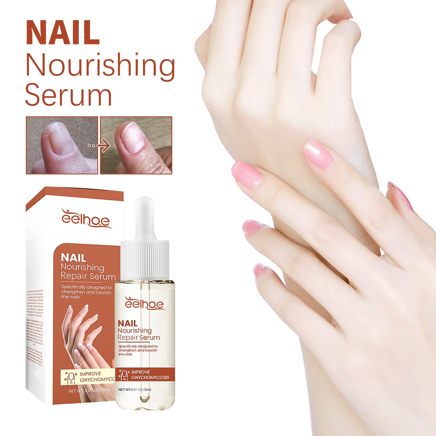 EELHOE Nail Care Essence Hand and Foot Nail Repair Soft Nail Thickening Moisturizing Brightening Nail Care Essence