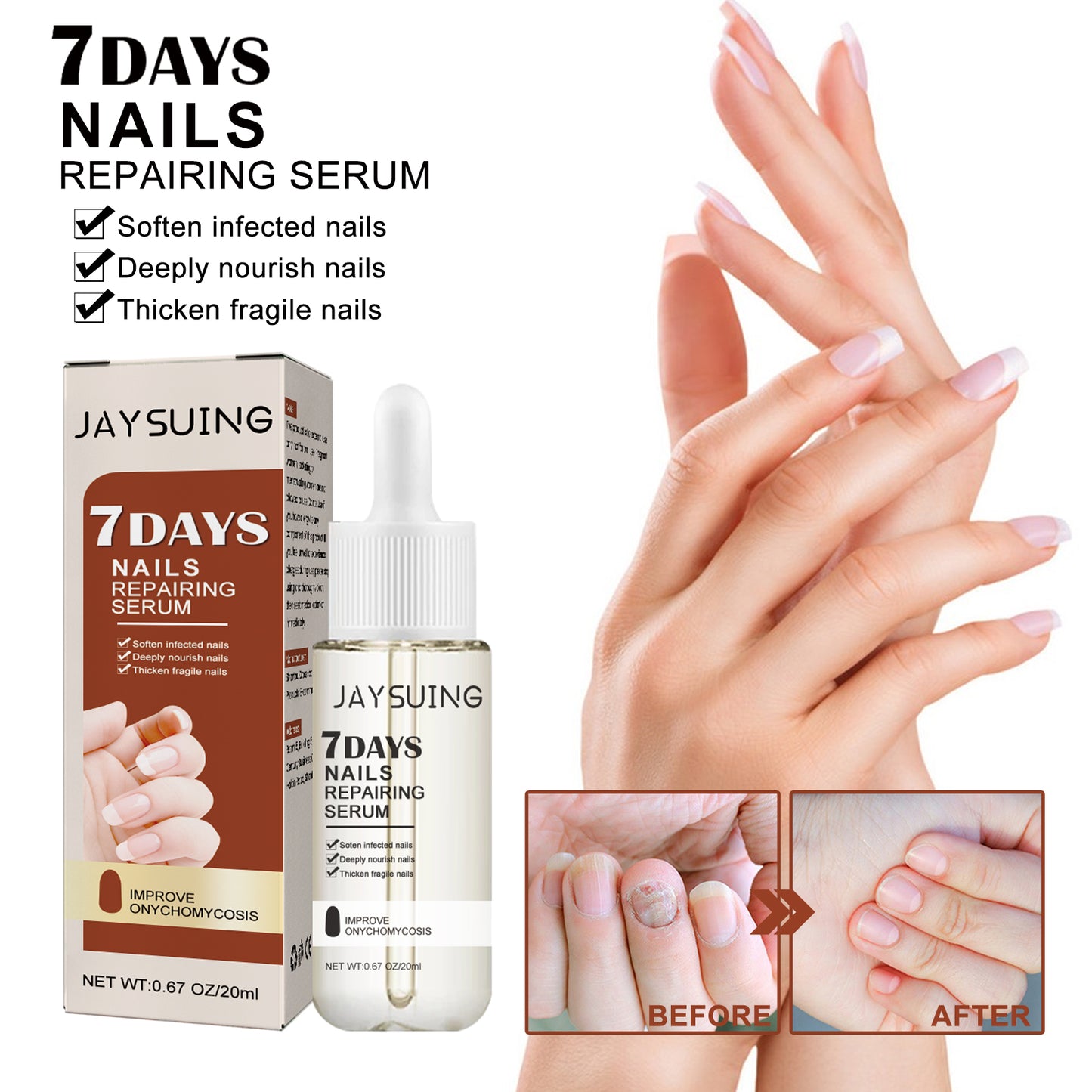 Jaysuing 7Sky Nail Care Essence Gray Nail Hand and Foot Nail Nutritional Cleansing Care Essence