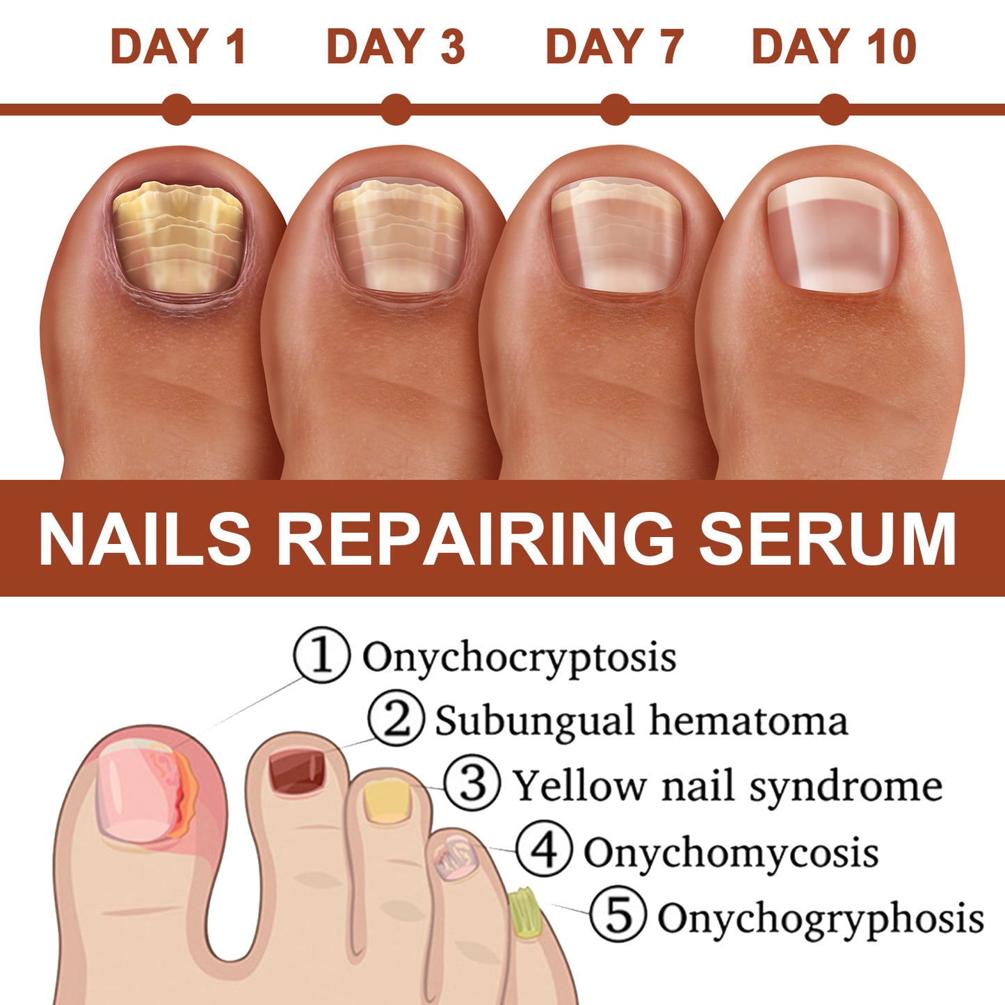 Jaysuing 7Sky Nail Care Essence Gray Nail Hand and Foot Nail Nutritional Cleansing Care Essence