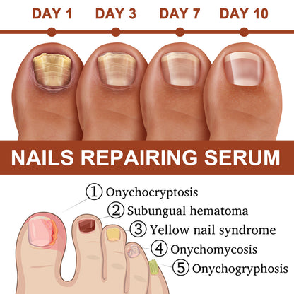 Jaysuing 7Sky Nail Care Essence Gray Nail Hand and Foot Nail Nutritional Cleansing Care Essence