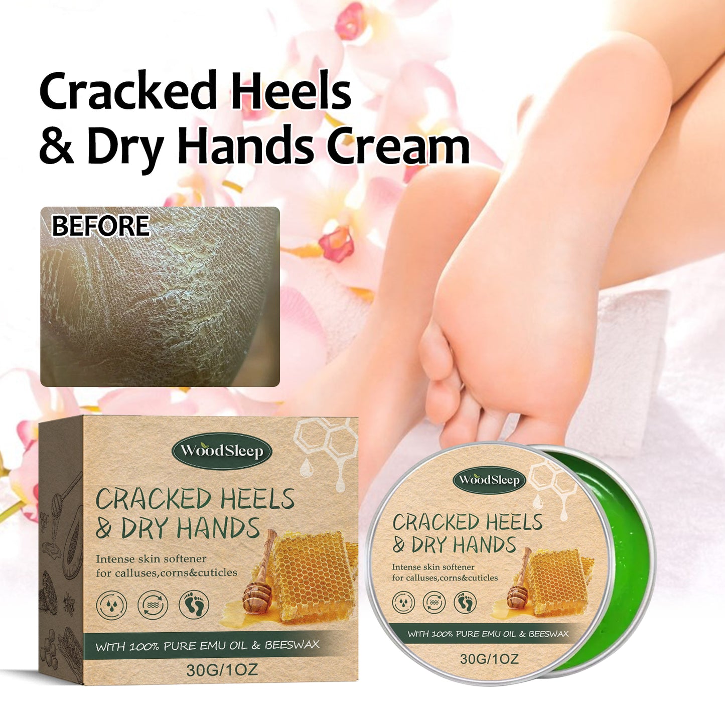 WoodSleep Anti-Chapping Hands and Feet Neck Cream Skin-Friendly Moisturizing and Anti-Cracking Peeling, Freezing, Cracking, Cracking, Hand and Foot Neck Cream