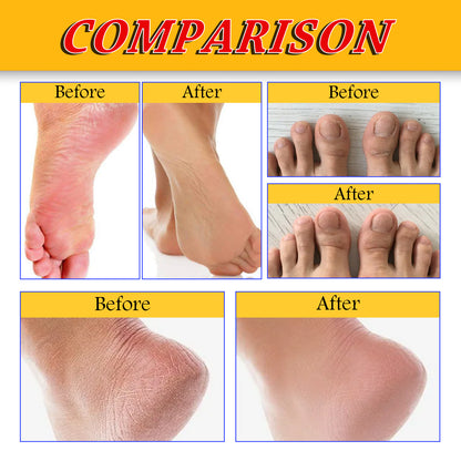 Jaysuing Foot Repair Cream Moisturizing Skin Anti Skin Cracked Dry Itchy Foot Care Repair Cream