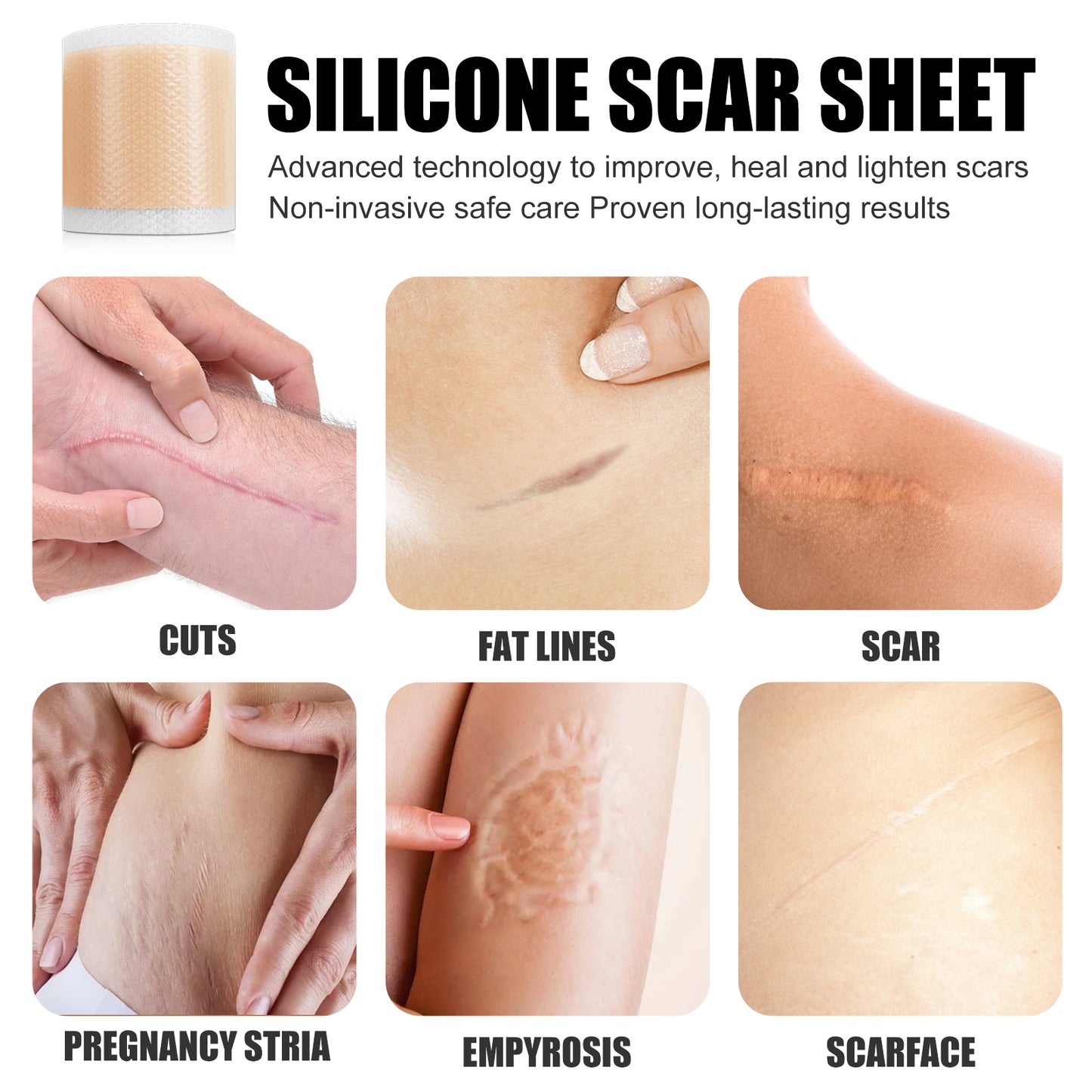 West&Month Self-Adhesive Silicone Scar Sticker Repair Orange Peel Lines Growth Lines Smooth Skin Care Beauty Patch