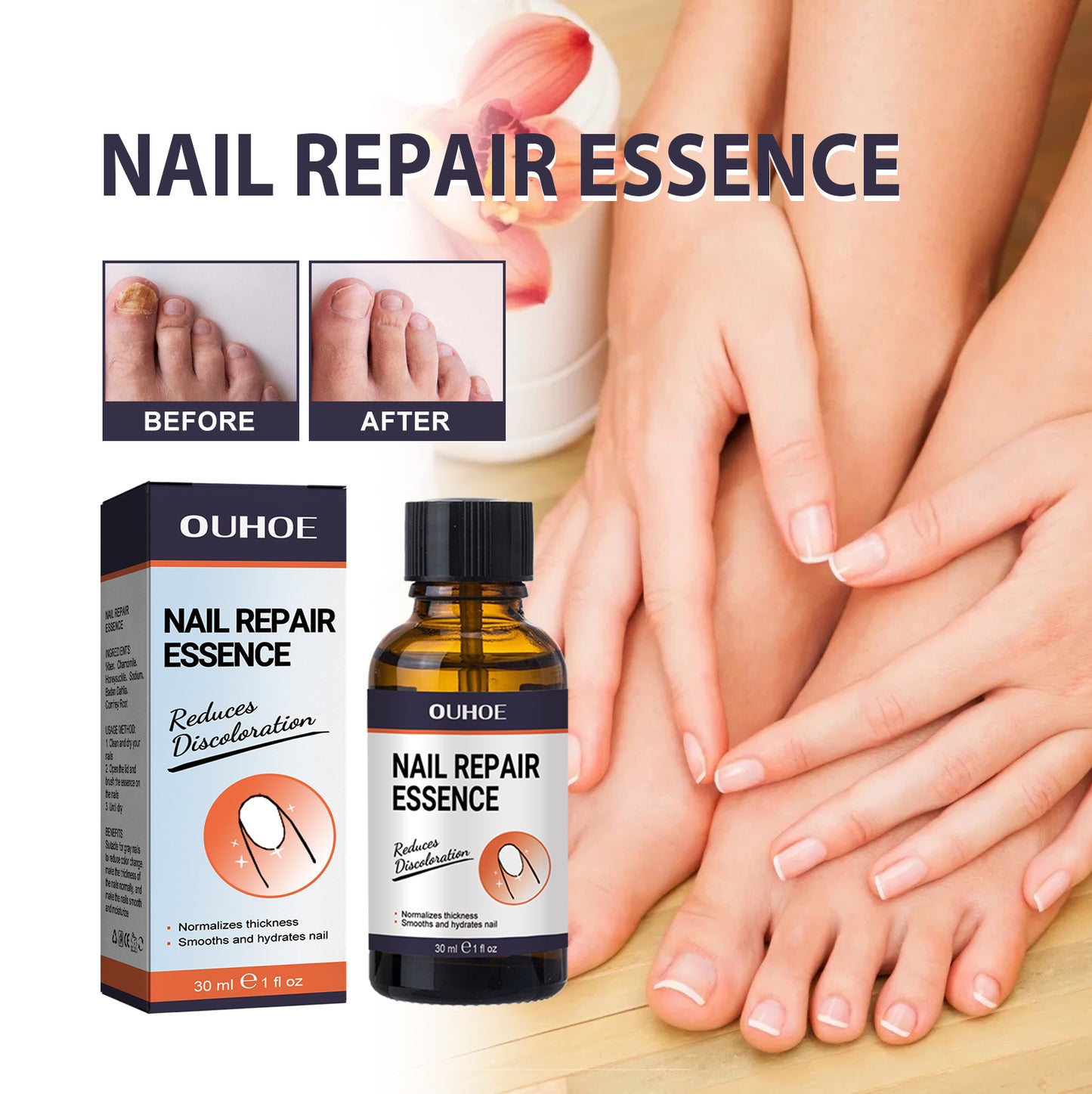 OUHOE Nail Repair Essence Soft Nail Thickening Nail Smooth Endogenic Nail Gray Nail Repair Essence