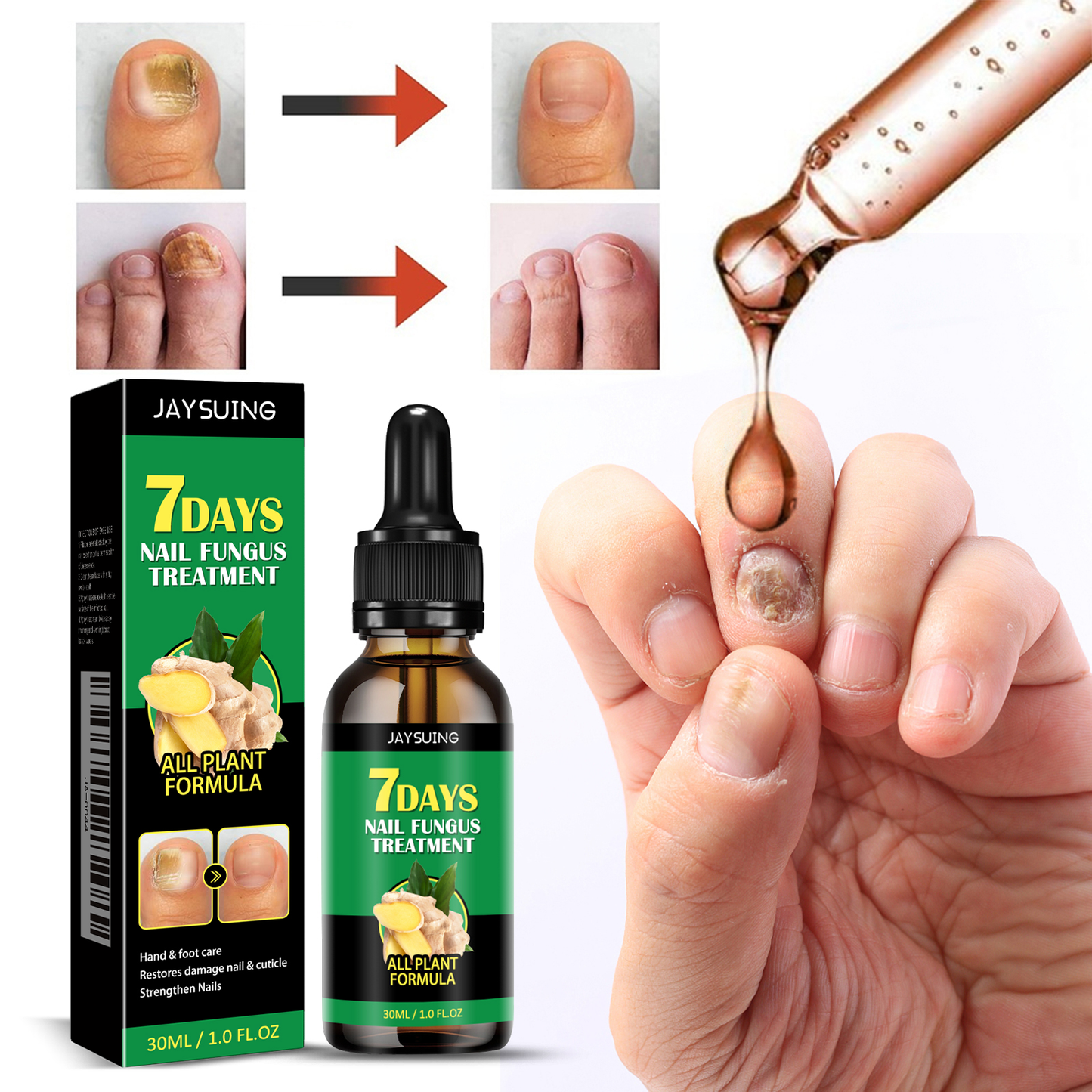 Jaysuing Ginger Nail Care Solution Nail Care Solution for Hands and Feet, Soft Nail Polish, Moisturizing Liquid for Nail Fungus