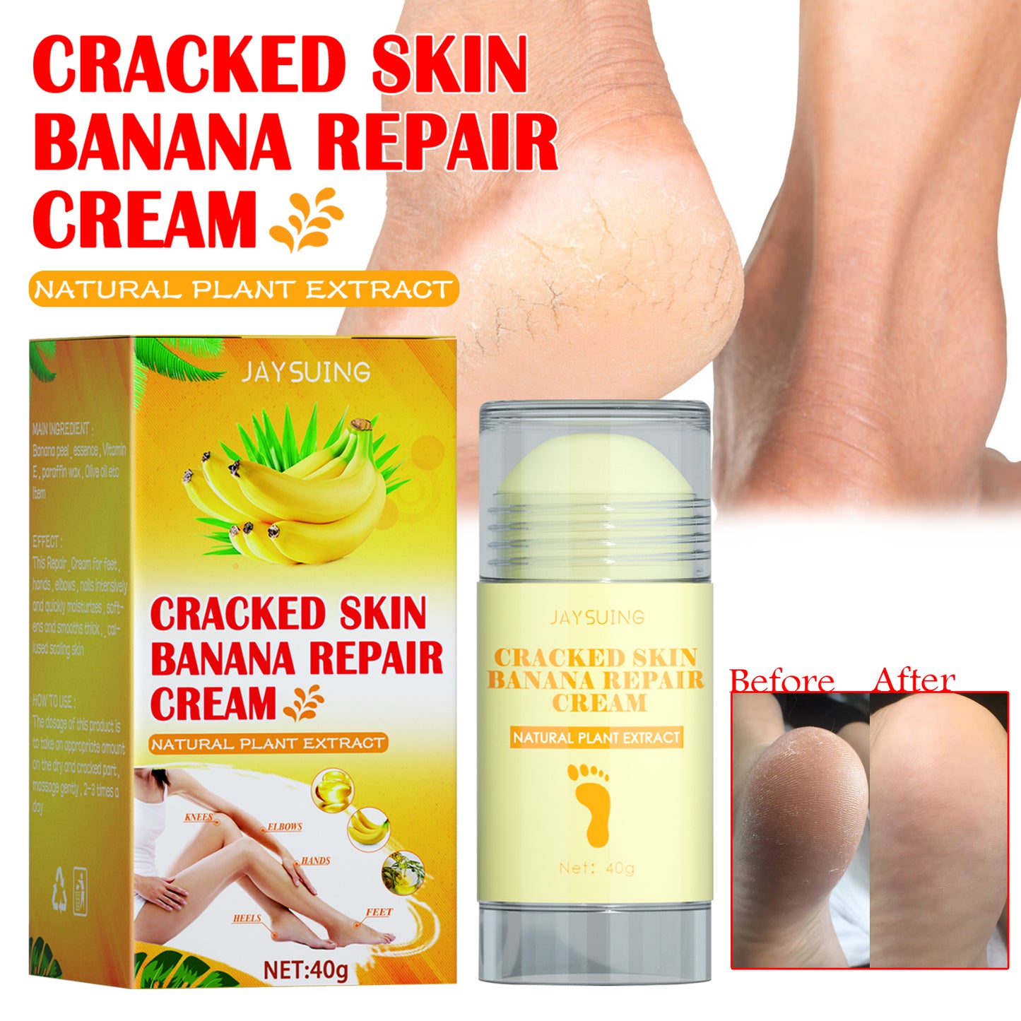 Jaysuing Foot Repair Cream Moisturizing Skin Anti Skin Cracked Dry Itchy Foot Care Repair Cream