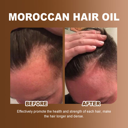 Hoegoa Morocco Hair Care Essential Oil Leave-in Hair Serum Repair Split Ends Dry Frizzy Lightweight Fragrance Non-greasy