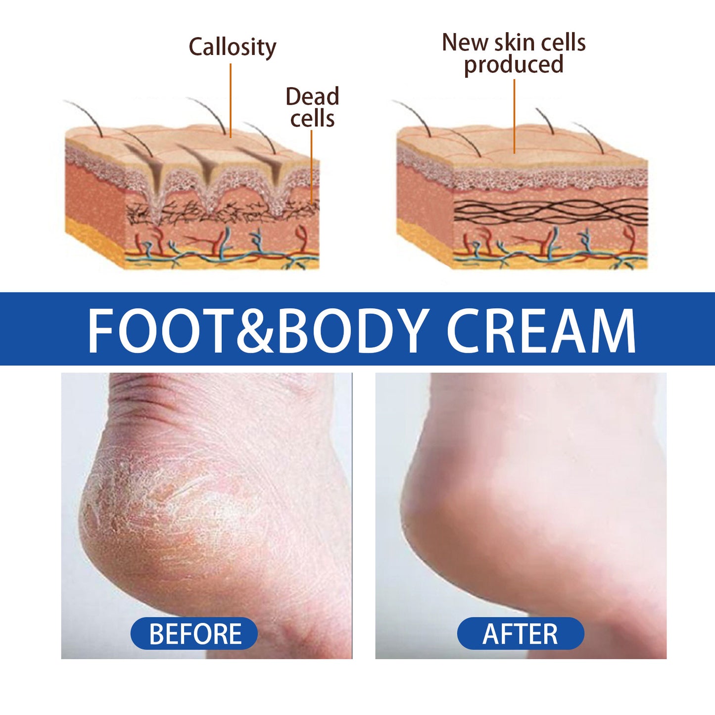 Hoygi Hand and Foot Moisturizing Cream Skin Hand Foot Anti-Freeze Dry Crack Peeling Moisturizing Hydrating Body Lotion