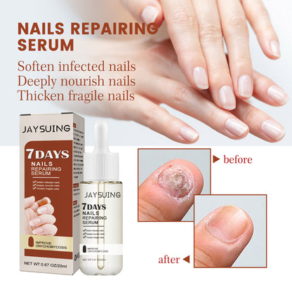 Jaysuing 7Sky Nail Care Essence Gray Nail Hand and Foot Nail Nutritional Cleansing Care Essence