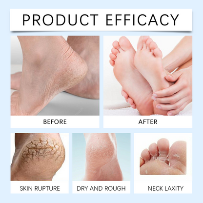 Wiyun Urea Moisturizing Foot Repair Cream Moisturizing Foot Hydrating Urea Foot Cream Soft Care