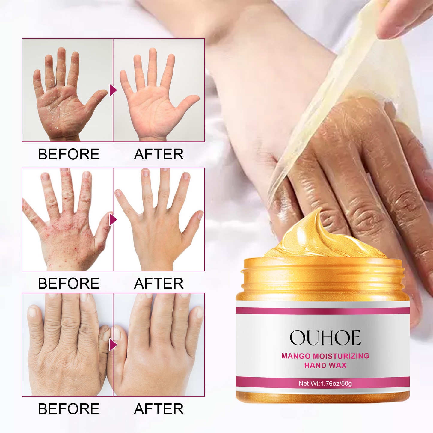 OUHOE Exfoliating Hand Mask Moisturizing and Softening Skin, Relieves Dry and Rough Hands, Prevents Cracking