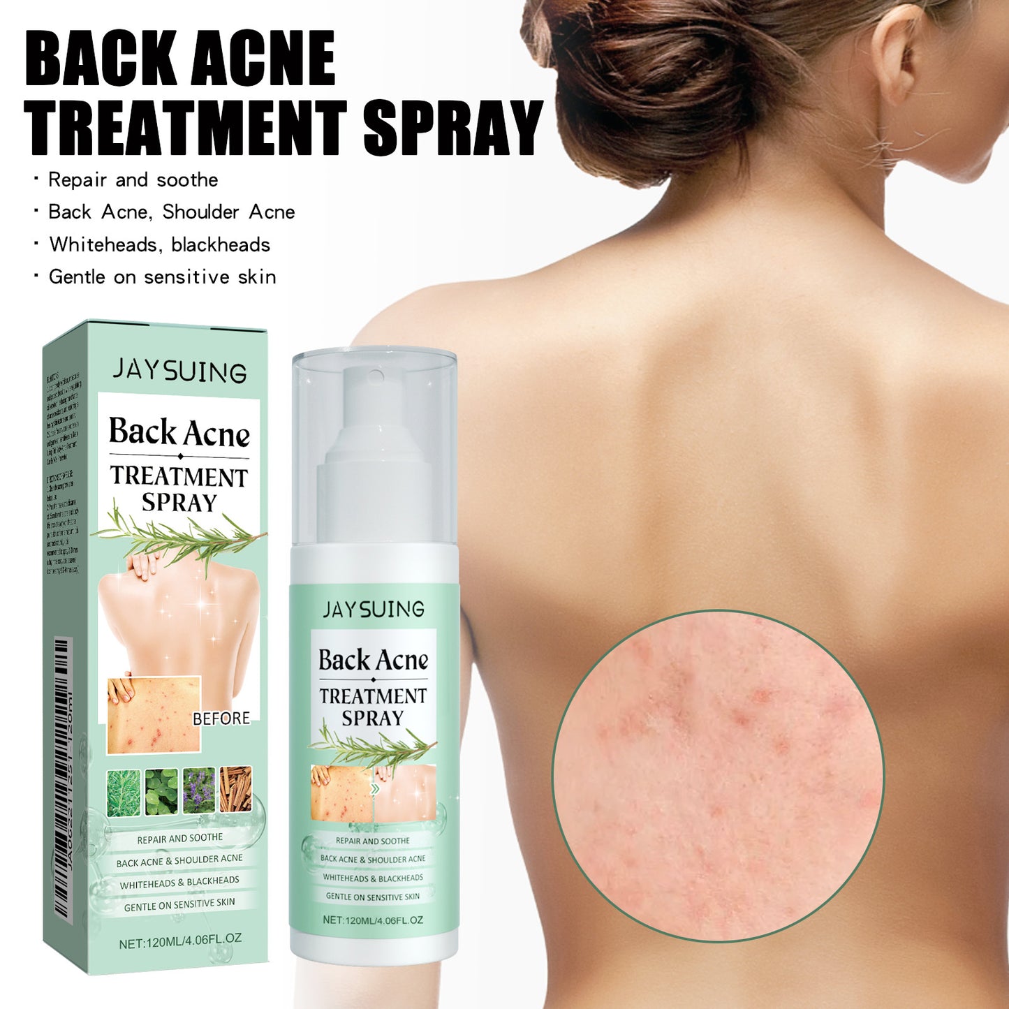 Jaysuing Back Care Spray Relieve Back Skin Moisturize Hydrate Body Clean Smooth Skin