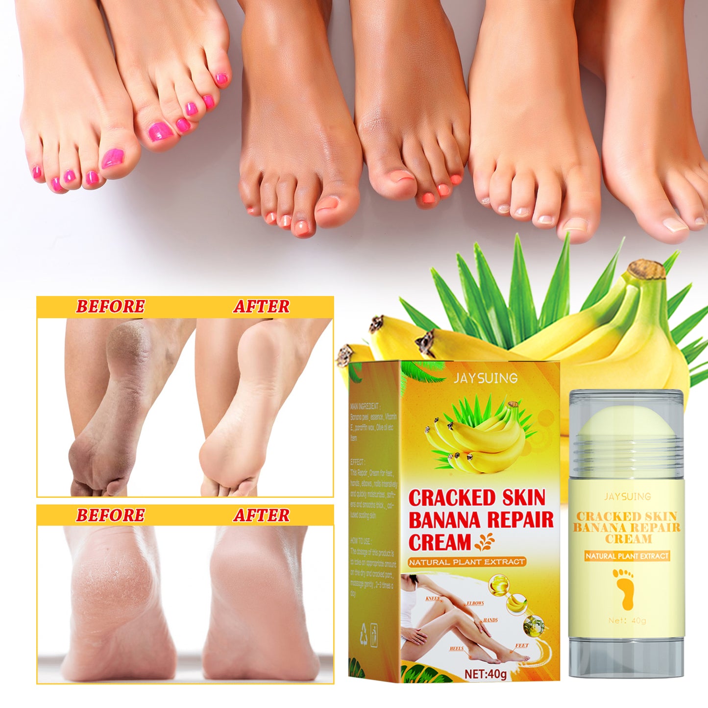 Jaysuing Foot Repair Cream Moisturizing Skin Anti Skin Cracked Dry Itchy Foot Care Repair Cream